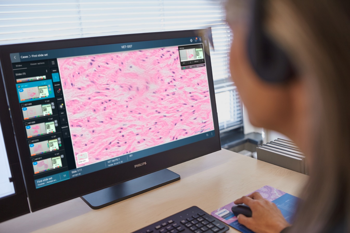 El SERIS inicia la digitalización del Servicio de Anatomía Patológica de los hospitales universitarios San Pedro y Calahorra por 1,3 millones de euros