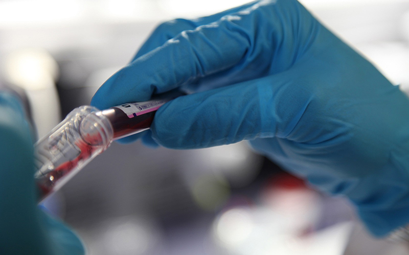 El Sistema Público de Salud de La Rioja implanta un nuevo sistema de información de laboratorio para optimizar la eficiencia y calidad de los análisis clínicos