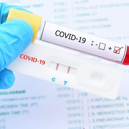 Recomendaciones para pacientes con COVID-19 positivo