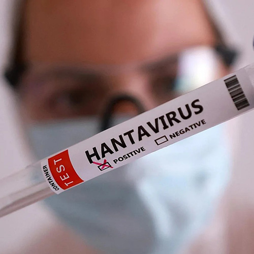 Hantavirus